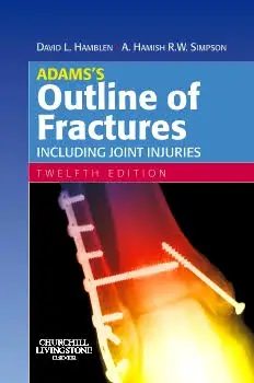 Outline of Fractures